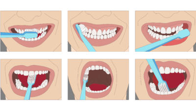 Infographic of how to brush teeth with different stages showing to brush teeth in back, in front, underneath, and behind